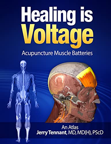 Healing is Voltage: Acupuncture Muscle Batteries von CREATESPACE